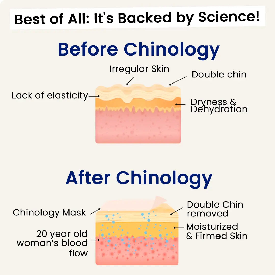 ChinLift - Become the Woman Who Loves Her Jawline Again