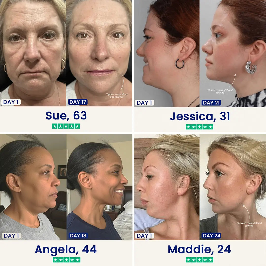 ChinLift - Become the Woman Who Loves Her Jawline Again