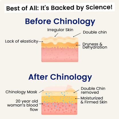 ChinLift - Become the Woman Who Loves Her Jawline Again